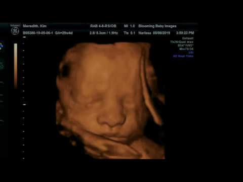 赤ちゃんの4dエコー 妊娠30週 Youtube