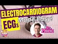 Ecgs ekgs made easy