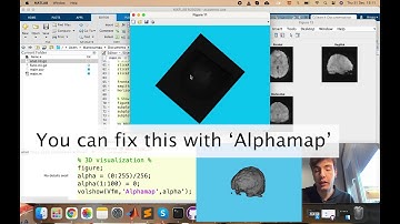 Basics of NifTI file visualization on MATLAB