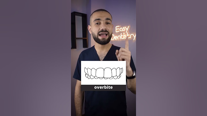 ٥ اشكال للاسنان تحتاج لتقويم الاسنان!! انت منهم؟🤔