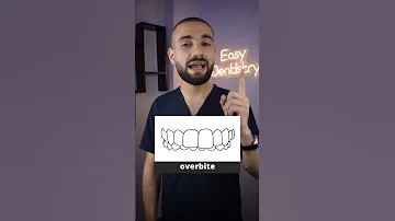 ٥ اشكال للاسنان تحتاج لتقويم الاسنان انت منهم 