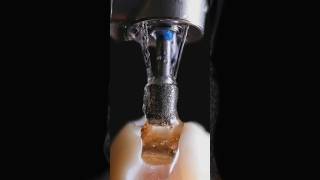 Dental Photography #dental #dentaltips #dentalhygiene #dentalcare #dentalclinic #tooth