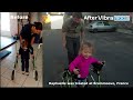 Testimonial - Vibramoov walk training Brain-Moove - Syndrome Pura