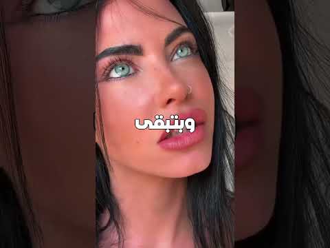 بنت لون عينيها حير العالم