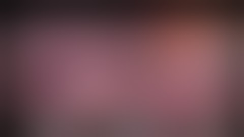 Laparoscopic Left Lobectomy, Left lateral sectionectomy