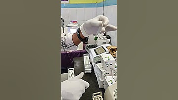 SERUM ALBUMIN TEST PROCESS IN LABORATORY||DMLT_RAJ||DMLT#SHORTS#VIDEO#LAB#SUBSCRIBE#CHANNEL