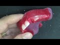 Maxillary Anterior Teeth Setting