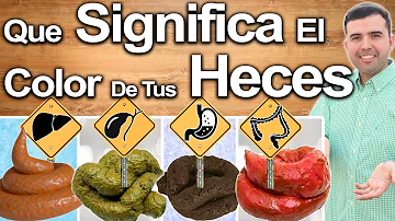 ¿Cuál es el color de las heces en el hígado graso?