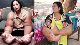 Woman Has The Biggest Hands In The World