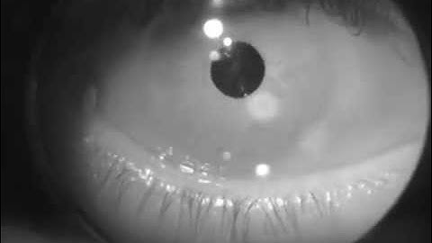 Eye tracker first video