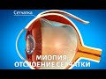 Миопия и отслоение сетчатки: кому поможет операция?