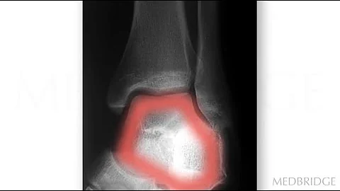 Ankle Imaging Views - Robert Boyles | MedBridge