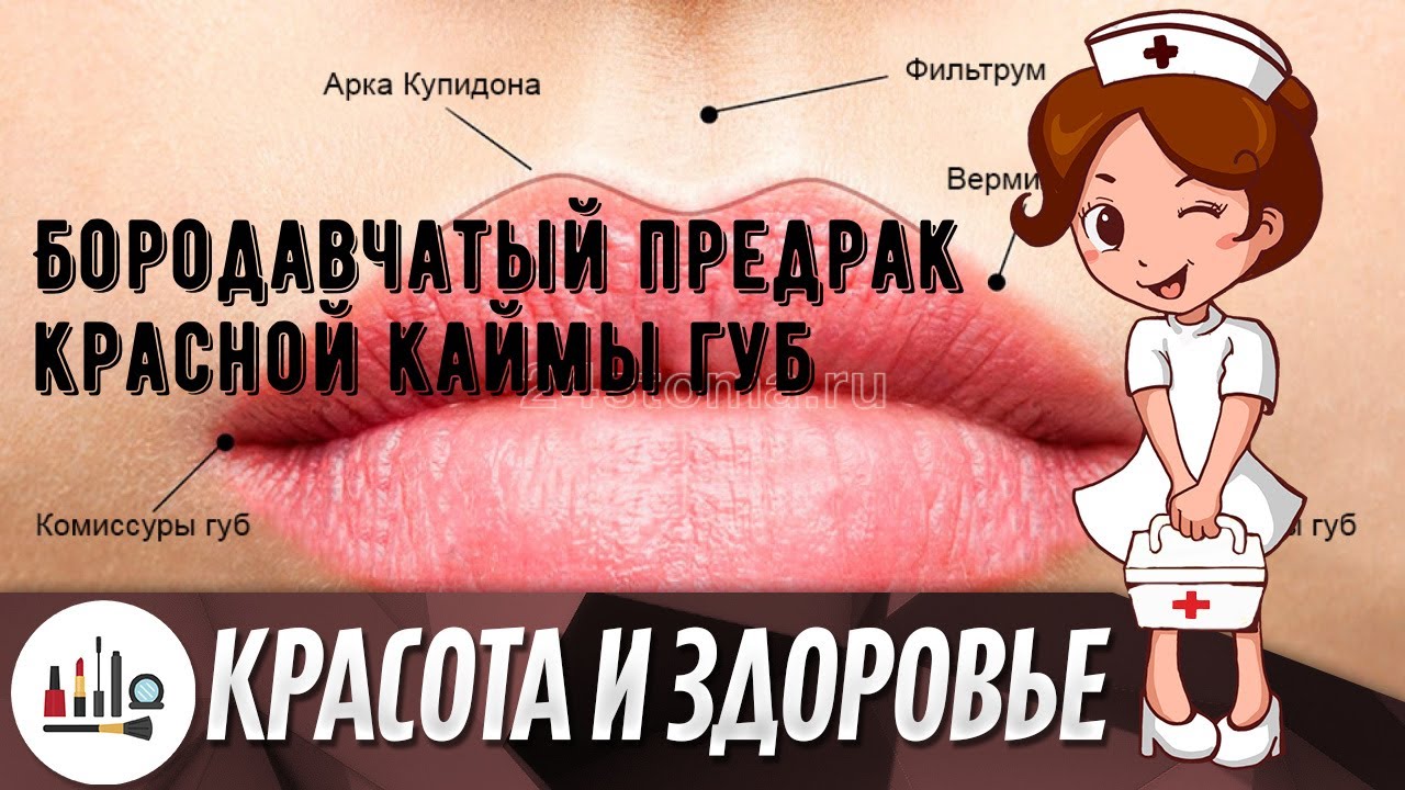 Бородавчатый предрак красной каймы губ