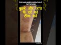 #health #doctor #acupuncture #cricket #sports #cricketlover #indore #muscle #gym #gymmotivation