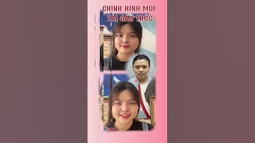 🌟 CHỈNH HÌNH MŨI KỸ THUẬT TÁI CẤU TRÚC VÒM 🌟