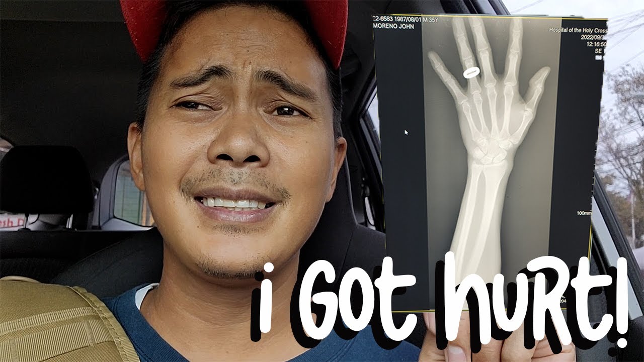 I Had To Get An X RAY In The Philippines YouTube I Had To Get An X RAY In The Philippines YouTube
