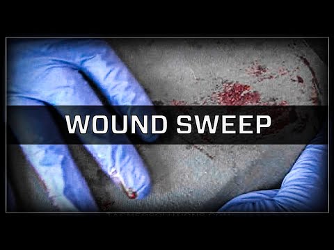 Performing a Wound Sweep