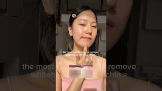 the most gentle way to remove whiteheads on your chin #skincaretips  #koreanskincare #whiteheads