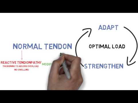 The Tendinopathy Continuum