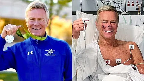 Warren's atrial fibrillation story