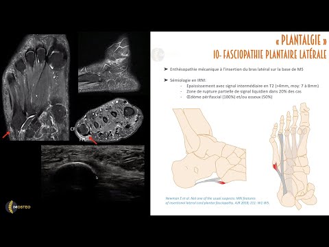 Vidéo: Expérience De Surmonter Avec Succès La Phobie De L'IRM