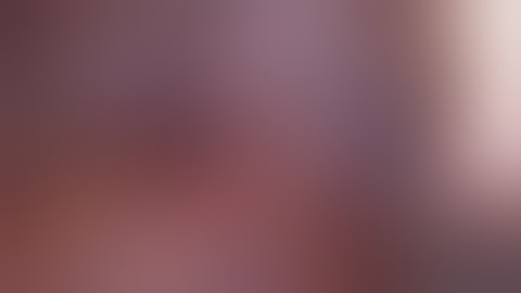 Left partial nephrectomy in retroperitoneoscopy for kidney cancer performed by Dr Goumas