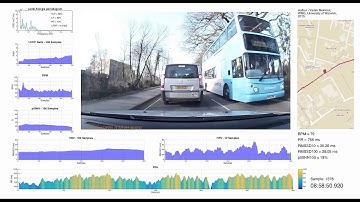 Driver Heart Rate Variability analysis using MATLAB & video representation of data