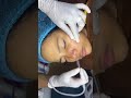 #facemassage #detoxfacemassage #faceserumforoilyskin #botox