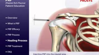 Orthopedic Prosys PRP KIT Solution