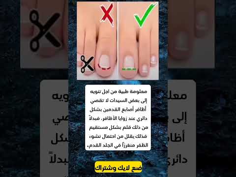 معلومة طبية من اجل تنويه إلى بعض السيدات لا تقصي أظافر أصابع القدمين بشكل دائري عند زوايا الأظافر