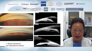 What are the mechanisms of angle closure? Do we consider all of them in the clinical practice?