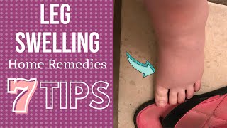 7 Tips for Leg Swelling Treatment at Home (Hindi)