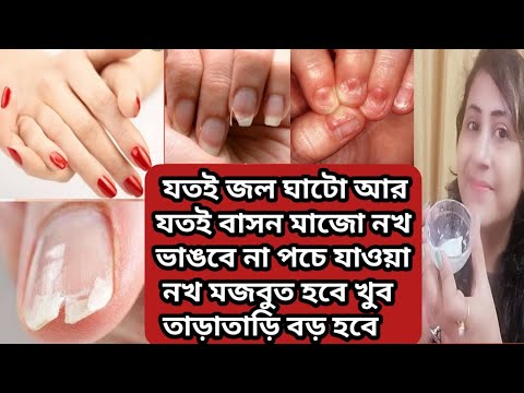 ভিডিও: জেল নখ দীর্ঘস্থায়ী করার Simple টি সহজ উপায়