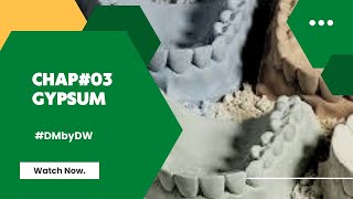 GYPSUM  PRODUCTS | Dental Materials|