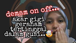 Update Braces Akar Gigi Geraham Tertinggal Dalam Gusi Aku