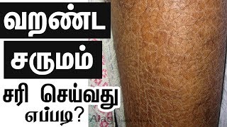 வறண்ட சருமம் சரி செய்வது எப்படி? - Home Remedy for Dry Skin – Natural Skin care – Tamil Beauty Tips screenshot 3