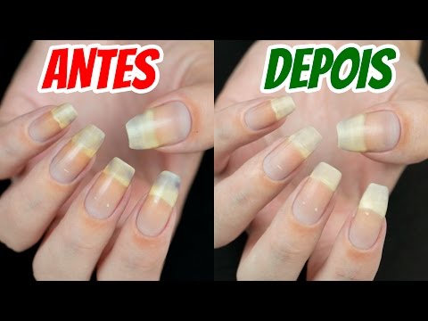 5 TRUQUES PARA TIRAR MANCHAS DE ESMALTES DAS UNHAS - #AnaTodoDia 20