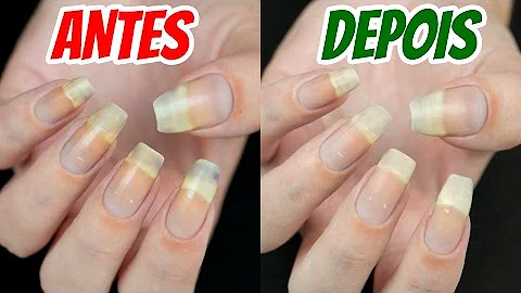 Como tirar manchas de esmalte nas unhas?
