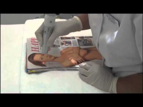 Magazine Ink Remove Video By Back 2 Bare