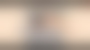 SmartTrader Rise / Fall Best strategy  xZ Index 100 Binary com.