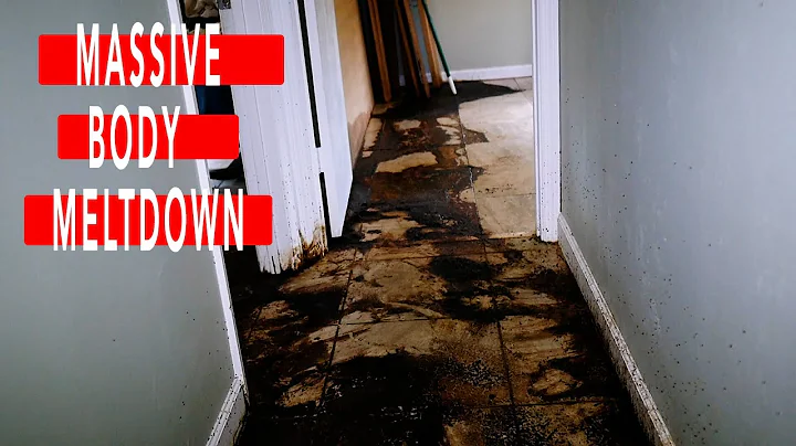 Massive Body Meltdown | Naples, FL