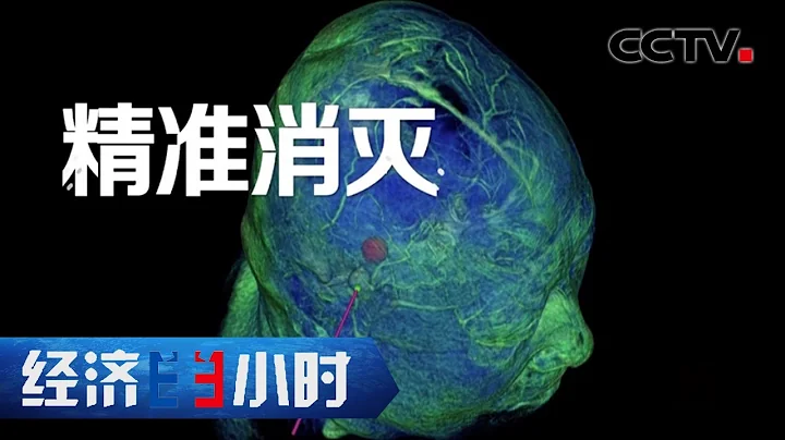 不开颅治疗脑肿瘤！癌症患者的“生命之光”！费用仅为国外的5%！“经济半小时”20210816 | CCTV财经 - 天天要闻