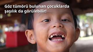 Göz Ve Orbita Tümörü Var Mı