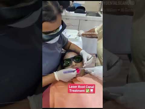 Laser Root Canal Treatment 😍😍 #dentist #dental #rootcanaltreatment #dentistry #dentalcare