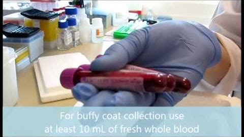 Nucleic Acid Purification from Blood Sample
