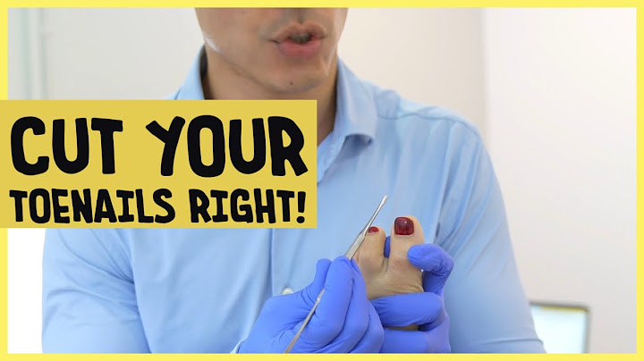 How to cut your toenails the proper way