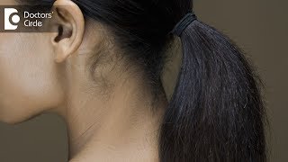 What Are The Causes Of Chronic Hair Loss And How To Treat It? - Dr. Kavitha Mandal G V