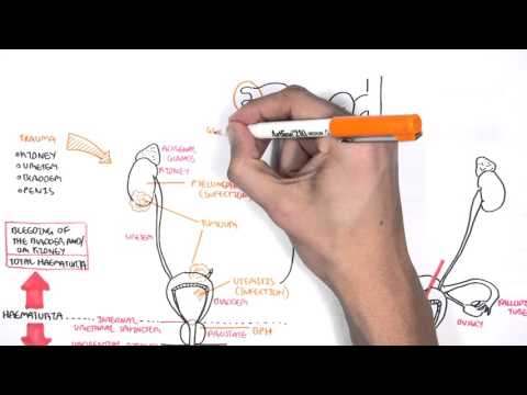 Videó: Hematuria - Orvosi Szakkifejezések Szótára