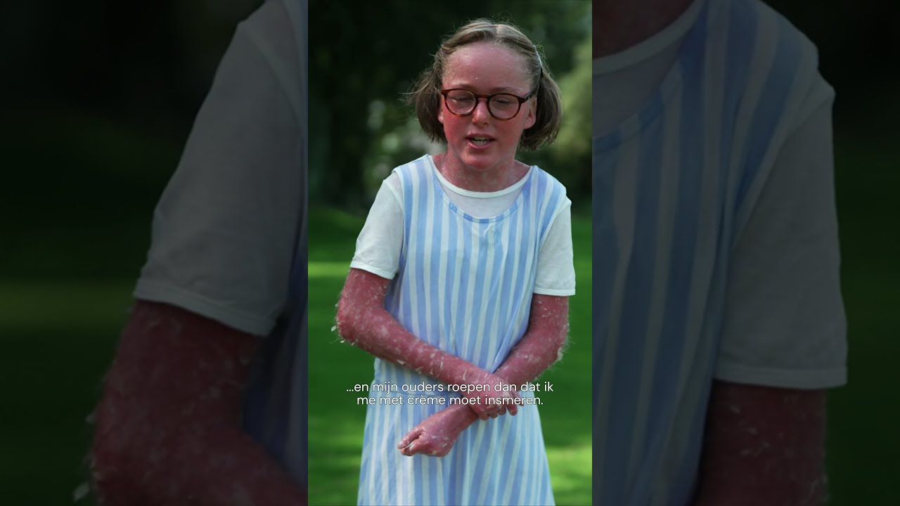 Nynke Heeft Ichtyosis Met Confetti Je Zal Het Maar Hebben Jr JZHMH IchtyosisMetConfetti Huid