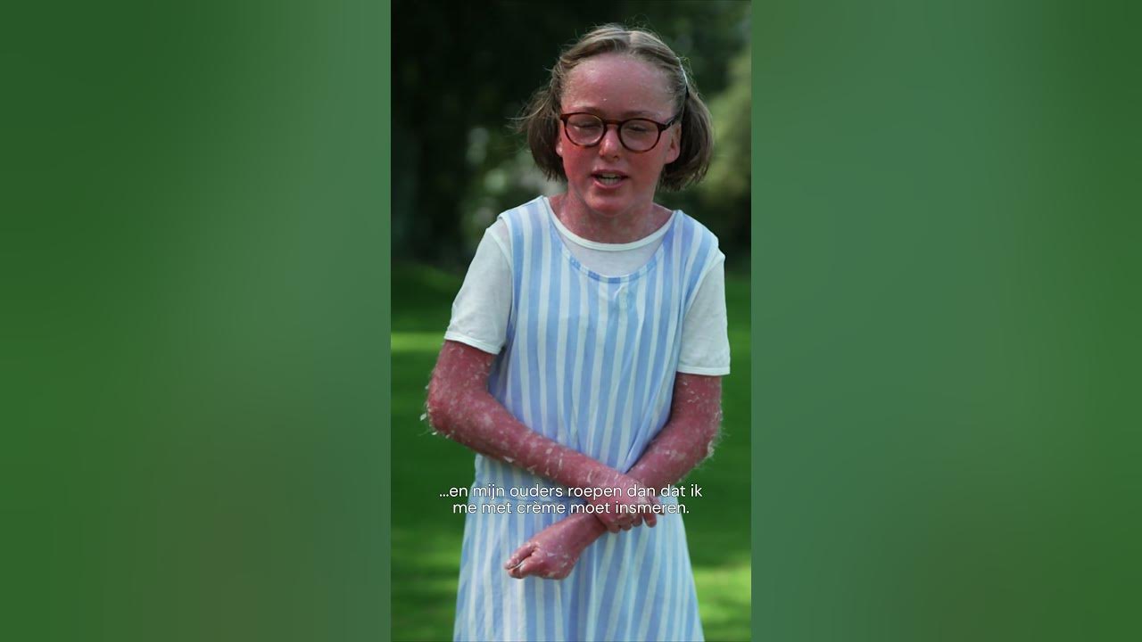 Nynke heeft Ichtyosis met Confetti - Je Zal Het Maar Hebben Jr. #JZHMH #IchtyosisMetConfetti #Huid